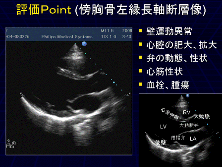 循環器画像技術研究会 / m3.com学会研究会