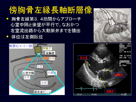循環器画像技術研究会 / m3.com学会研究会