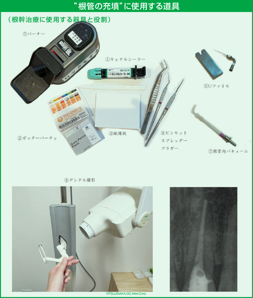 根管治療（こんかんちりょう）について | 千里丘 辻中歯科・矯正歯科