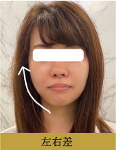 フェイススリムブースターセラム Face Slim Booster Serum - gran-9