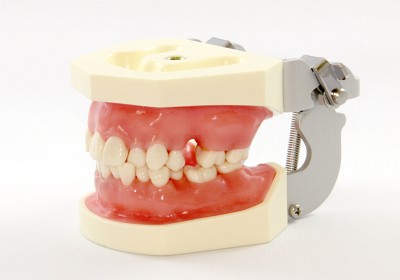 ニッシン - 顎模型（咬合器付き） P15FE-SRP.2（加藤久子モデル