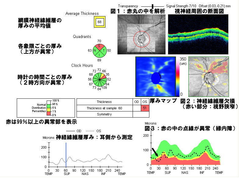 田中眼科最新設備