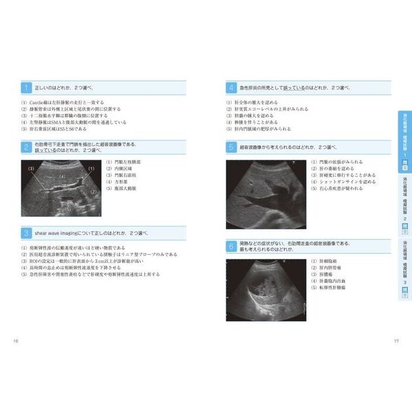 超音波検査士認定試験対策 過去問分析～出題のポイントで学ぶ！ 臨床編