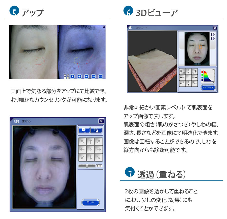 肌診断機器 A-ONE Lite（エイ・ワン・ライト） | ㈱神戸メディケア