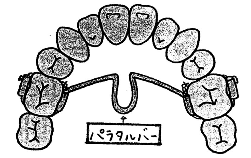 レベルアンカレッジシステム|【田隅矯正歯科クリニック】姫路駅直結の