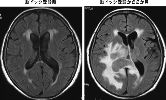 悪性脳腫瘍部門｜部門紹介｜医局紹介 | 東京医科大学 脳神経外科