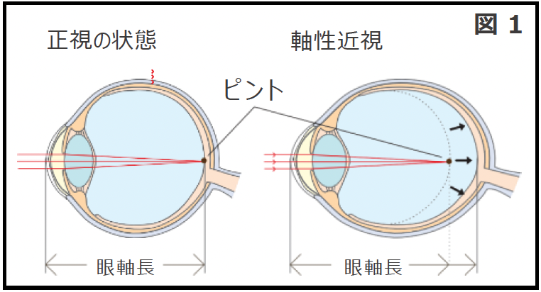リジュセアミニ0.025%点眼液｜てつもと眼科（神戸市北区）