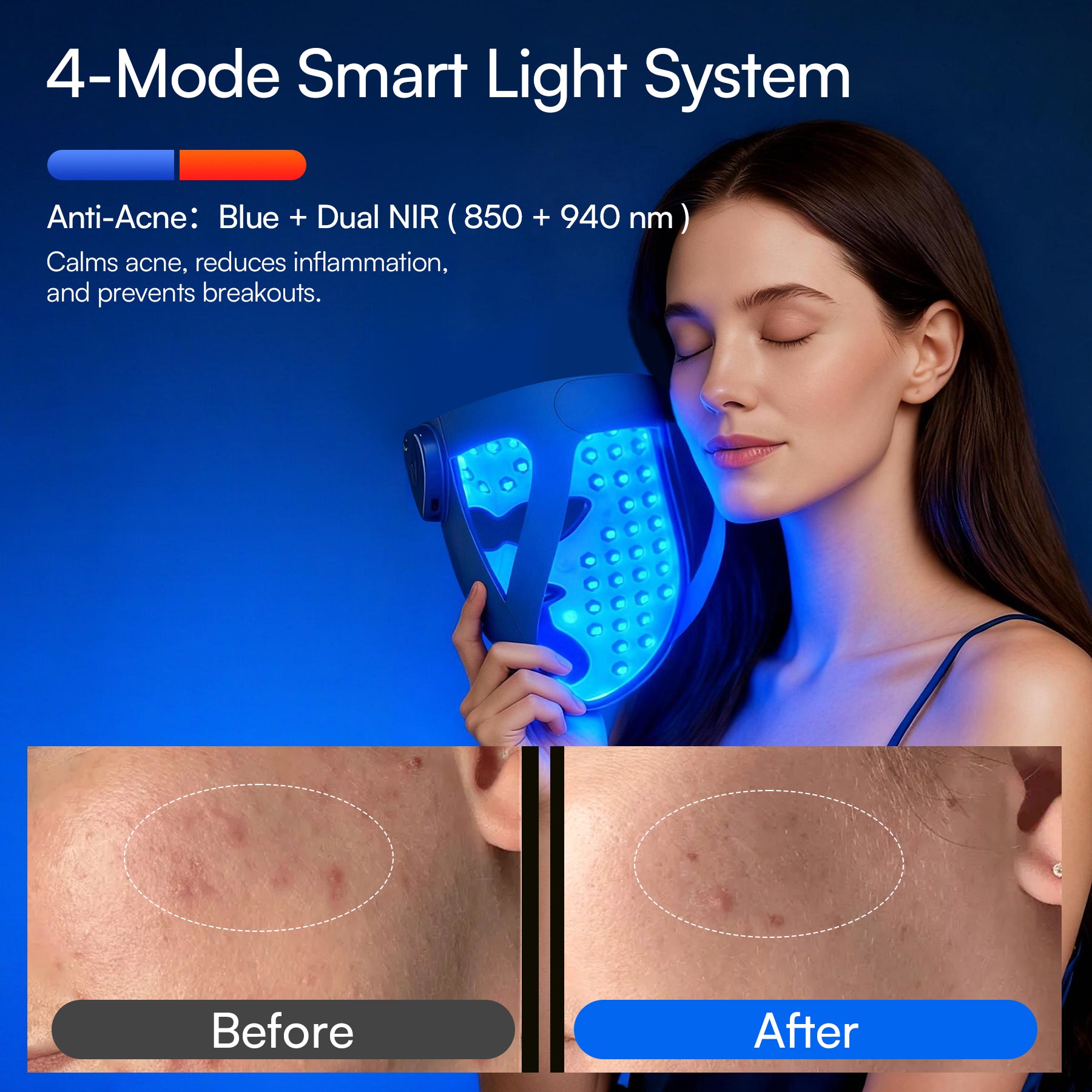 INIA GLOW 4D 940nm Dual NIR Wireless LED Mask