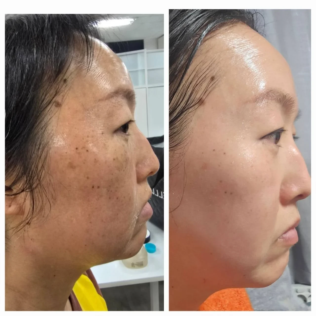 韓国発「インセルダム」が日本上陸、GrandFusionがサロン導入支援を