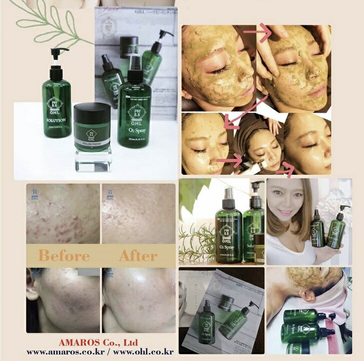 楽天市場】アマロス OHLソリューション 容量250ml(AMモイスチャーPゲル