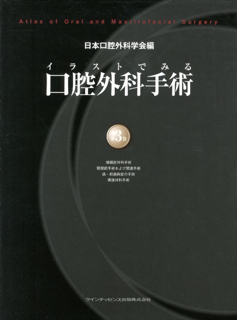 楽天ブックス: イラストでみる口腔外科手術（第3巻） - 日本口腔外科