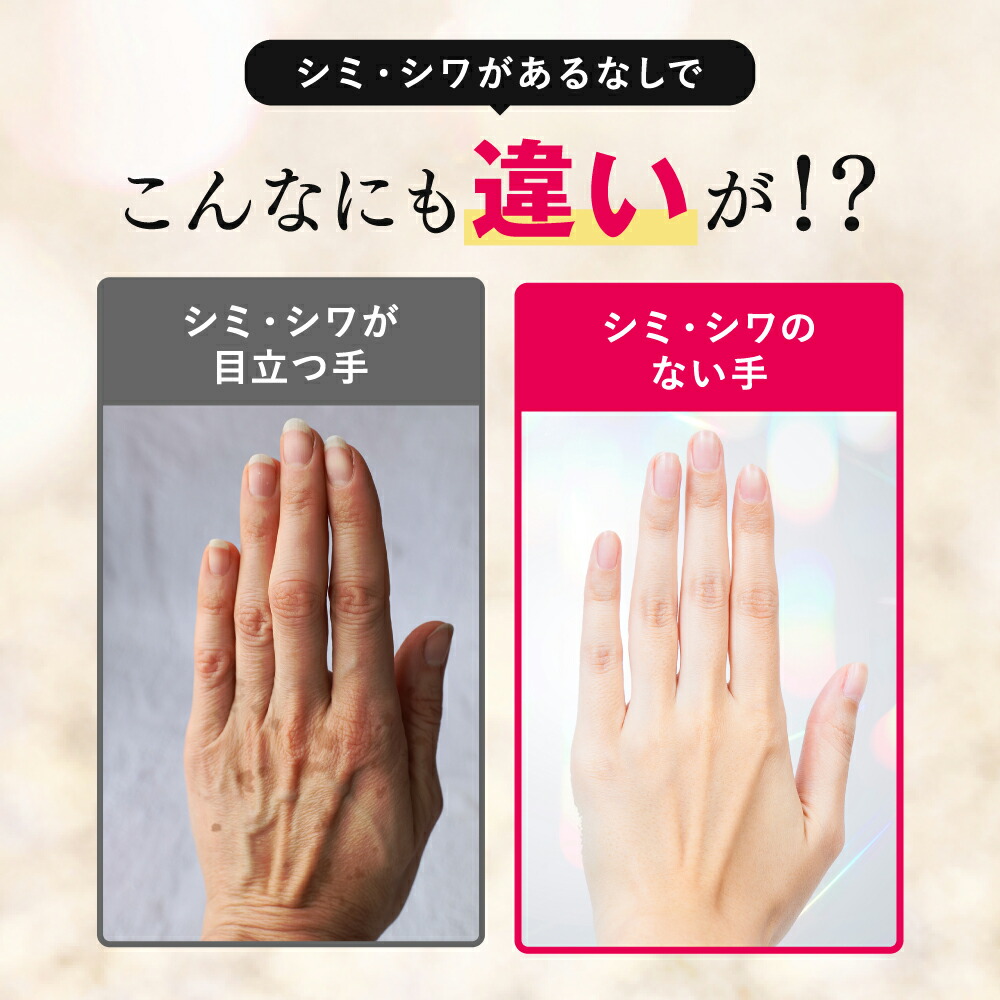 楽天市場】【話題のハンド美容液】薬用 ホワイト ハンドセラム 美容液