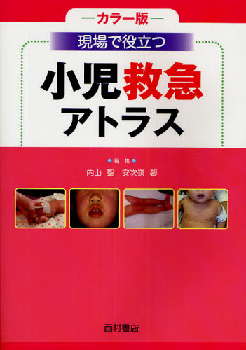 楽天市場】アトラスさくま 小児咽頭所見の通販