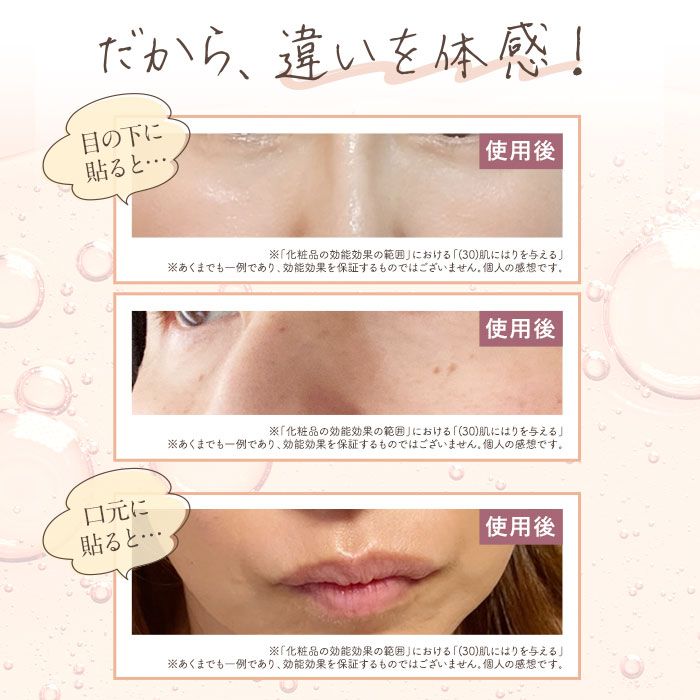 楽天市場】2個セット【公式】北の快適工房 ヒアロディープパッチ 売上