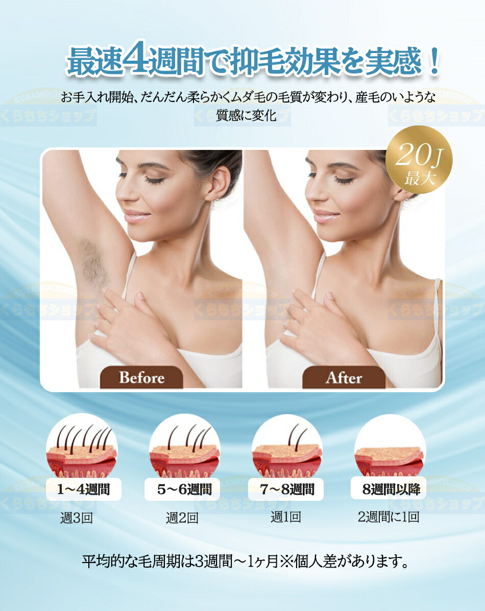楽天市場】脱毛器 無痛脱毛 自動照射 60万発9段階 全身適用 VIO対応