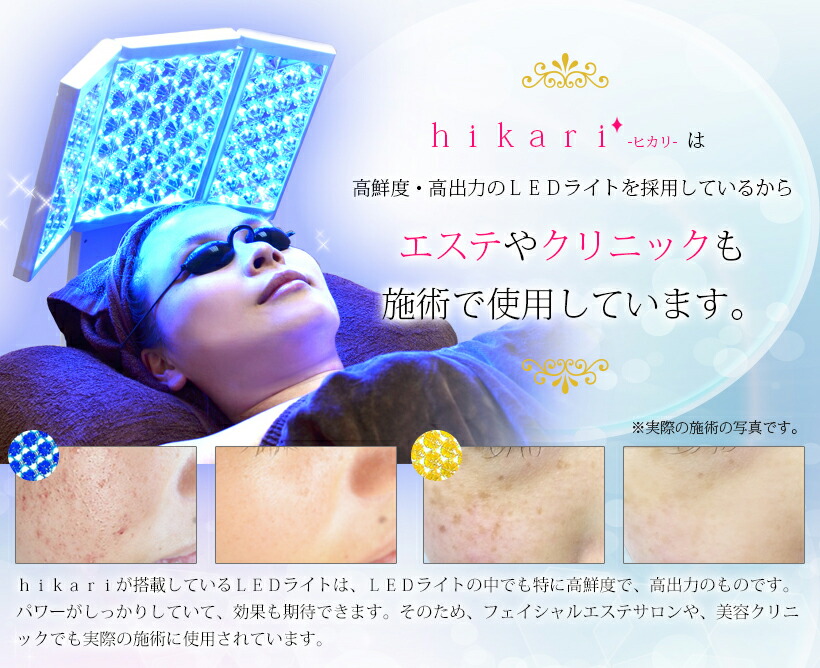 楽天市場】0と5のつく日限定⇒38800円 LED美顔器 フォトフェイシャル