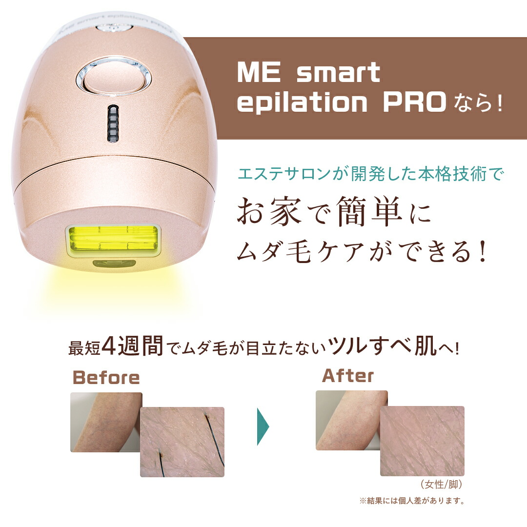 楽天市場】光脱毛器 【MEスマートエピレーションプロ】 光美容器 光