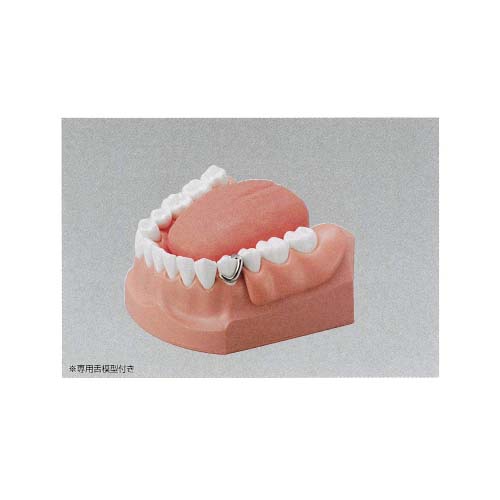 楽天市場】口腔内 模型 頬の通販