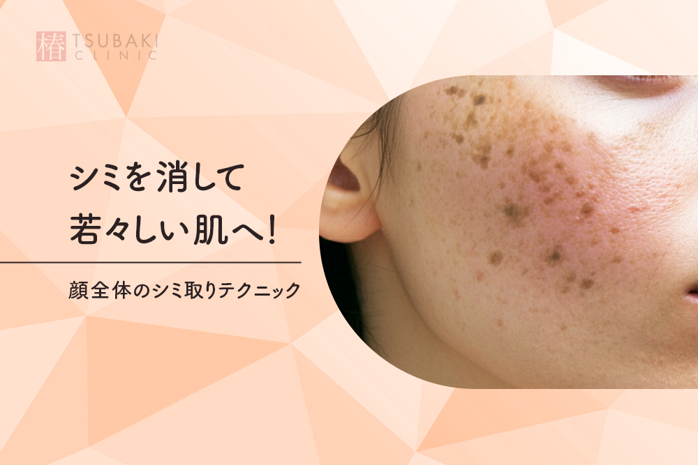 シミを消して若々しい肌へ！顔全体のシミ取りテクニック - 銀座