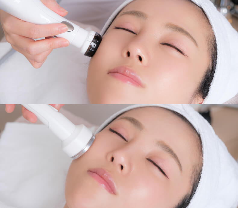 プラズマシャワー・ハイドラフェイシャル・フェイスリフト・毛穴