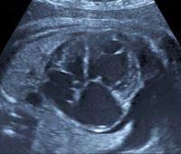 所見から探る産科超音波診断