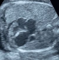 所見から探る産科超音波診断