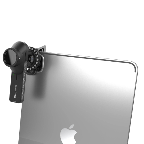 DermLite DL1 Dermatoscope | DermLite Dermatoscopes