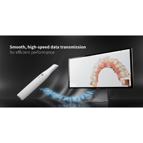 Alliedstar Sensa Wireless Intraoral Scanner – Voxel Dental