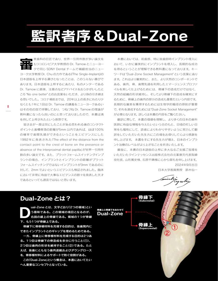 シングル・トゥースインプラント