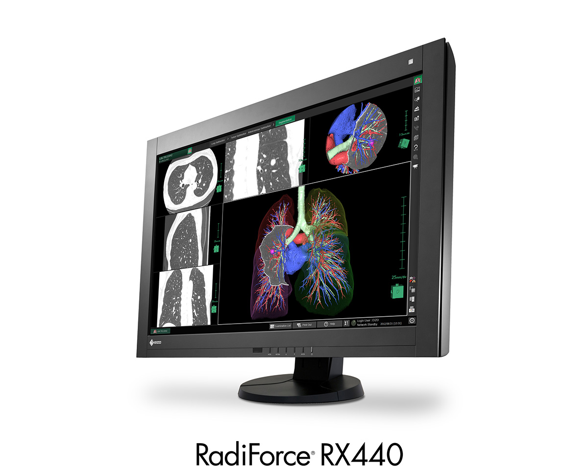 RadiForce RX440 | EIZO