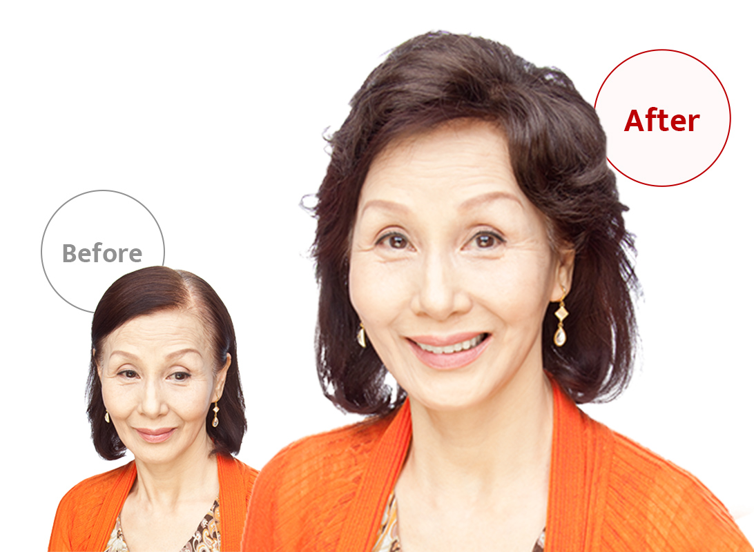 ウィッグユキのポイントウィッグを部分別にご紹介