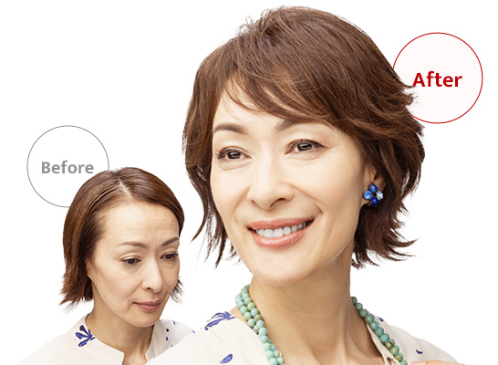 ウィッグユキのポイントウィッグを部分別にご紹介