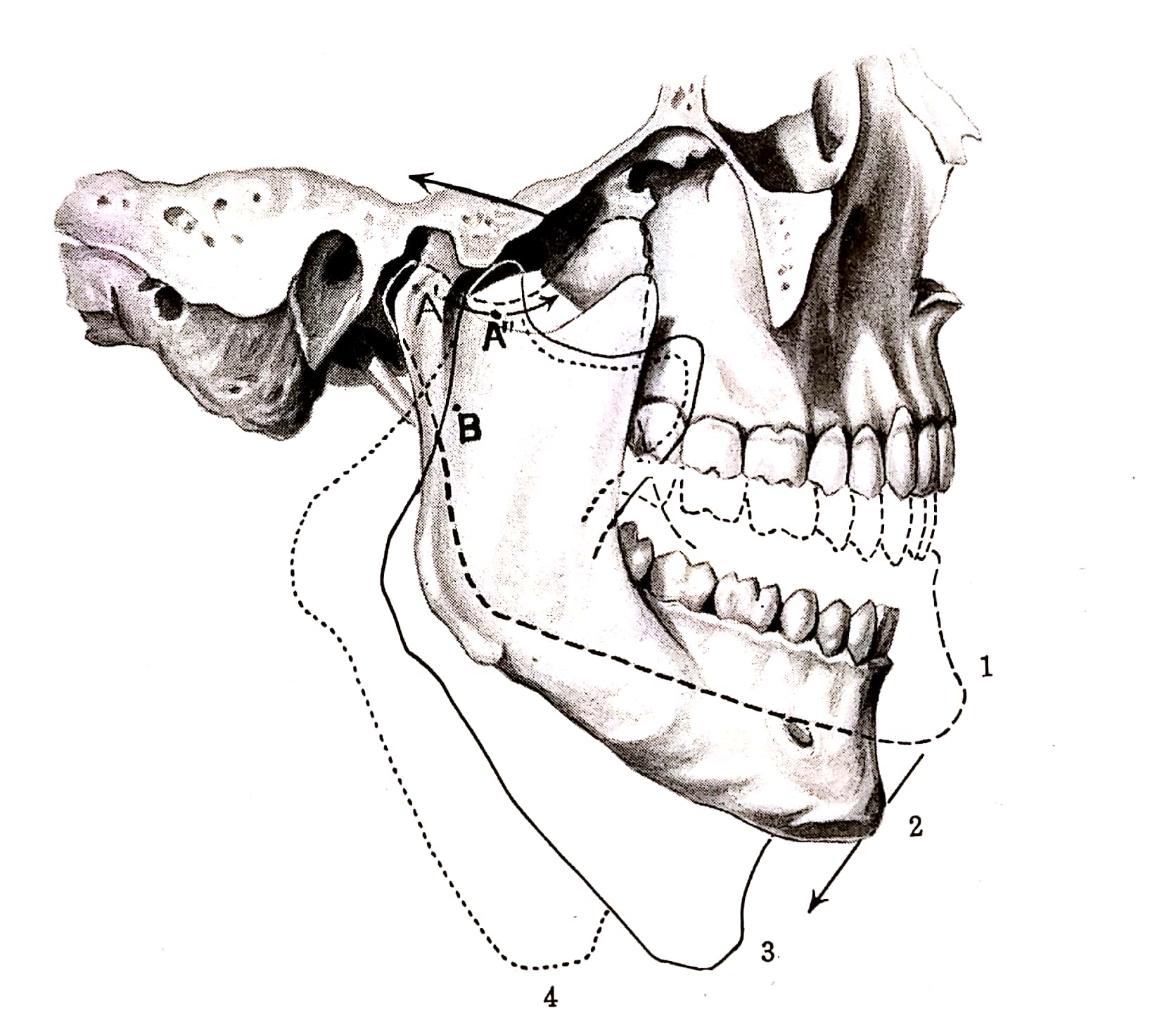 TMJ（顎関節）症候群 | ココから整体