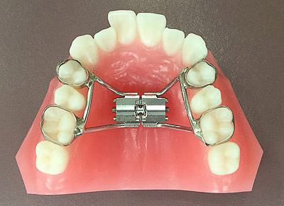 顎顔面矯正ってどんな矯正？｜カトレア歯科・美容クリニックよくあるご質問