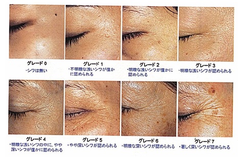 モリンダ 新製品美容液「テマナ ノニ ブライトニング セラム」 「乾燥