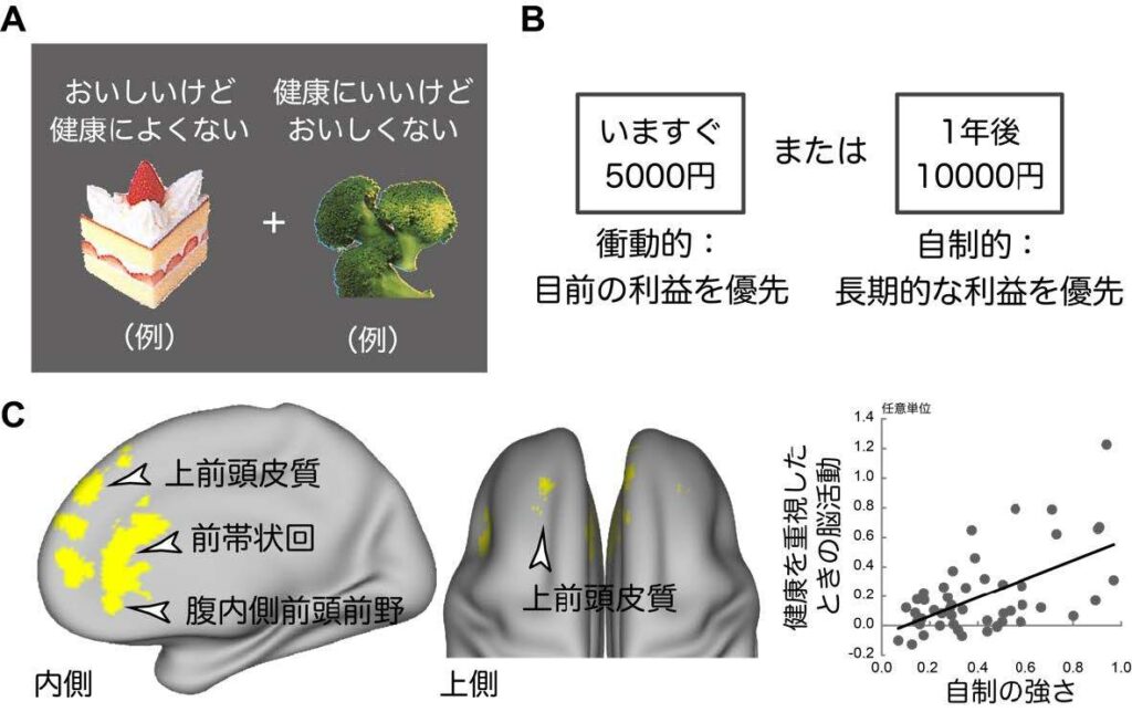 健康を優先した食べ物の選択における脳機構を解明： おいしさの誘惑を