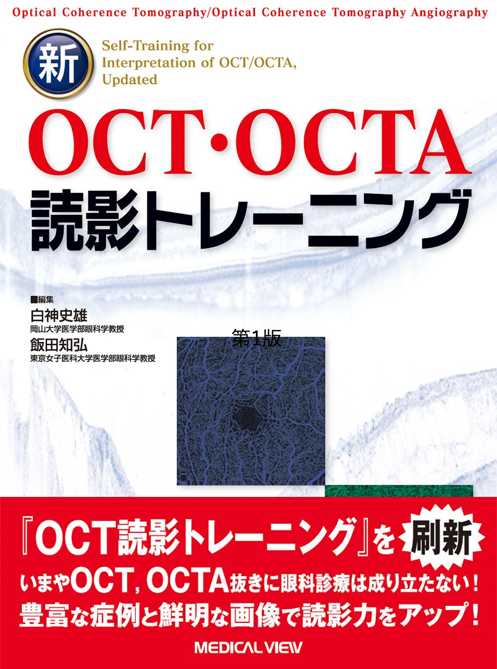 新OCT・OCTA読影トレーニング 改訂第2版 - 眼科専門書店 オー・ビー