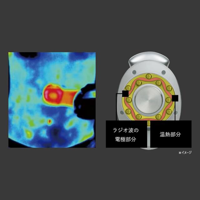 ヤーマン キャビスパプレステージ for Salon-美容機器の卸/仕入れなら