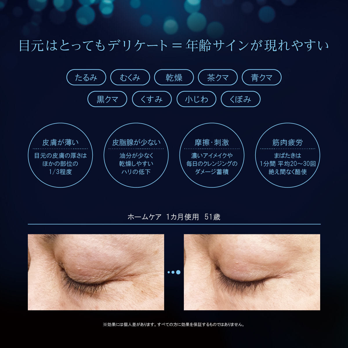 数量限定】ラボプラス ADノーブル インプレッションアイコントアー 1g