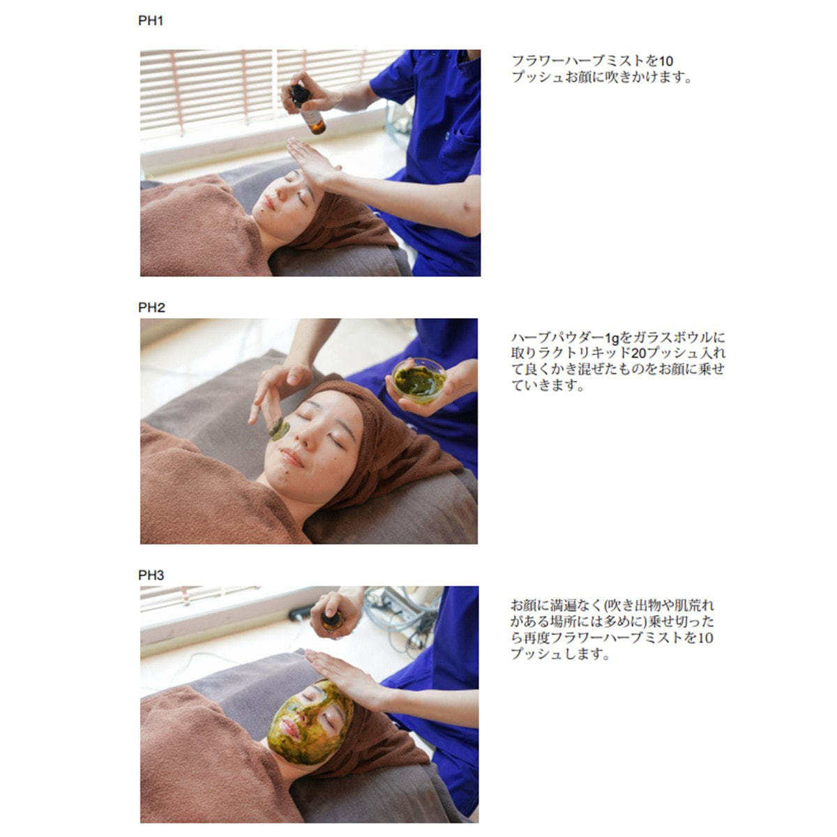 Upm フラワーハーブピーリング®エクソソームセットの卸・通販