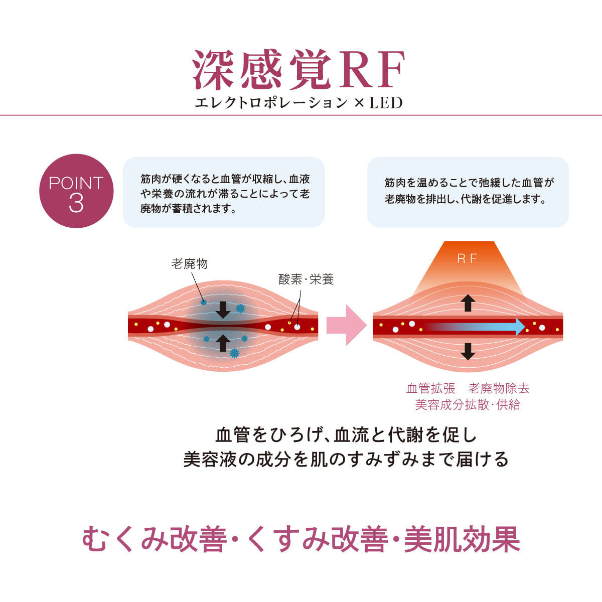 数量限定】ICR Beauty ミニキュア エクセレントⓇ【日本製】購入特典