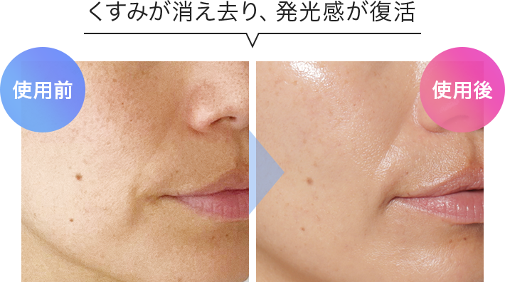 QuSomeホワイト2.0 スペシャルページ | スキンケア化粧品・サイエンス