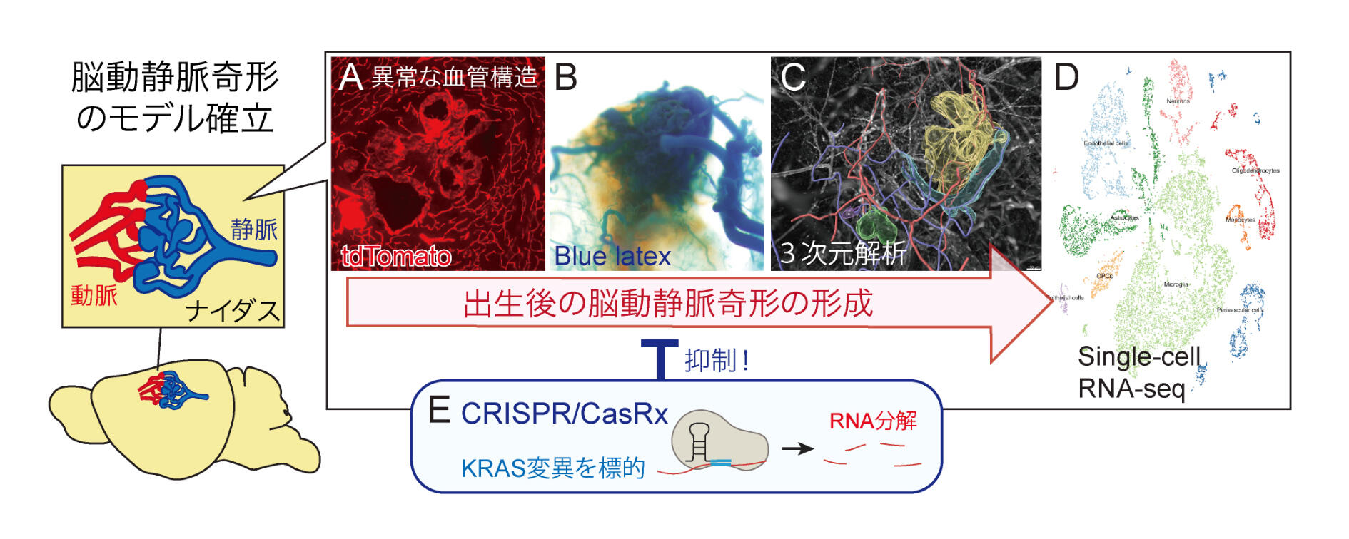 脳動静脈奇形の発症プロセスを再現 －異常な脳血管構造の形成機序解明