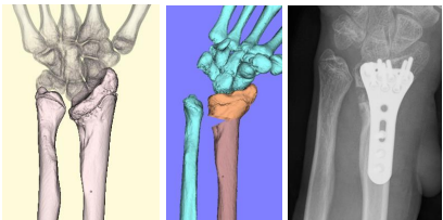 四肢外傷治療センター | 地方独立行政法人大阪府立病院機構 大阪急性期