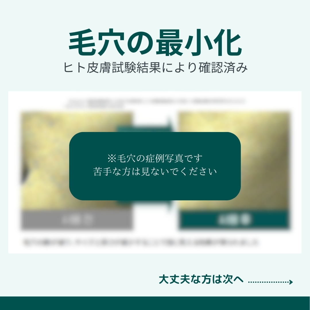 iLLON 【iLLON肌再生セット】MESOPRO®+&鎮静マスク / DOCTOR EXPRESS