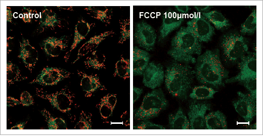 ミトコンドリア膜電位検出キット JC-1 MitoMP Detection Kit 同仁化学