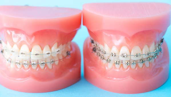 矯正のと費用｜田園歯科クリニック｜中央林間駅から徒歩30秒と近い