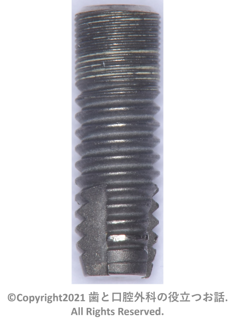 Astra Tech Implant System OsseoSpeed Straightについて | 歯と口腔