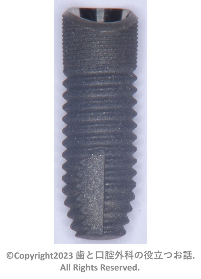 Astra Tech Implant OsseoSpeed Profile EVについて | 歯と口腔外科の