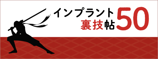 インプラント裏技帖50| 歯科総合出版社 デンタルダイヤモンド社